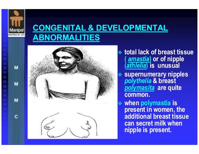 congenital anomalies of the breast Cricket vagina video